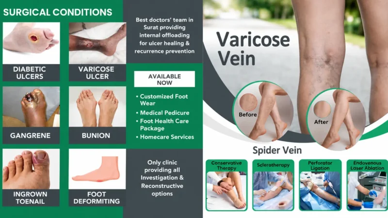 How to Heal a Diabetic Foot Ulcer: Why Offloading Is the Step That Decides