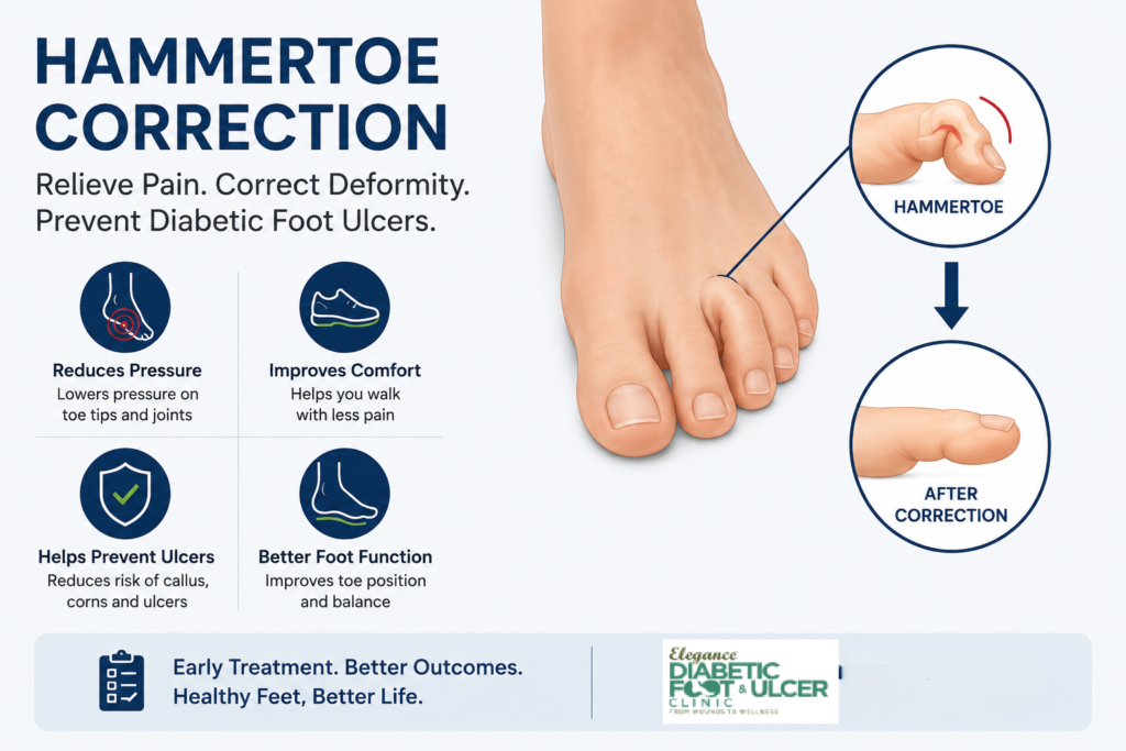 Hammertoe Correction
