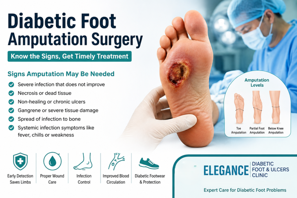 diabetic foot amputation surgery