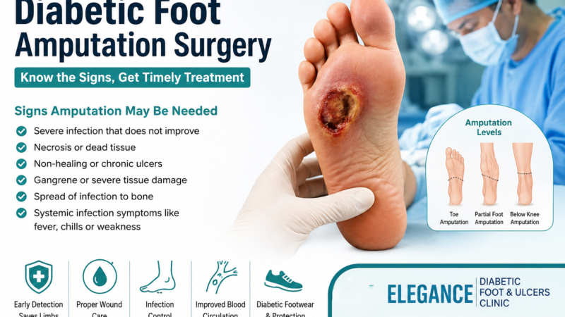 What Are the Signs That Diabetic Foot Amputation May Be Needed?