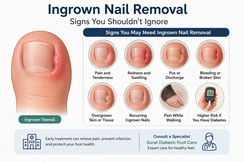ingrown nail removal