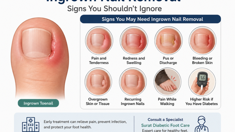 What Are the Signs You Need Ingrown Nail Removal?
