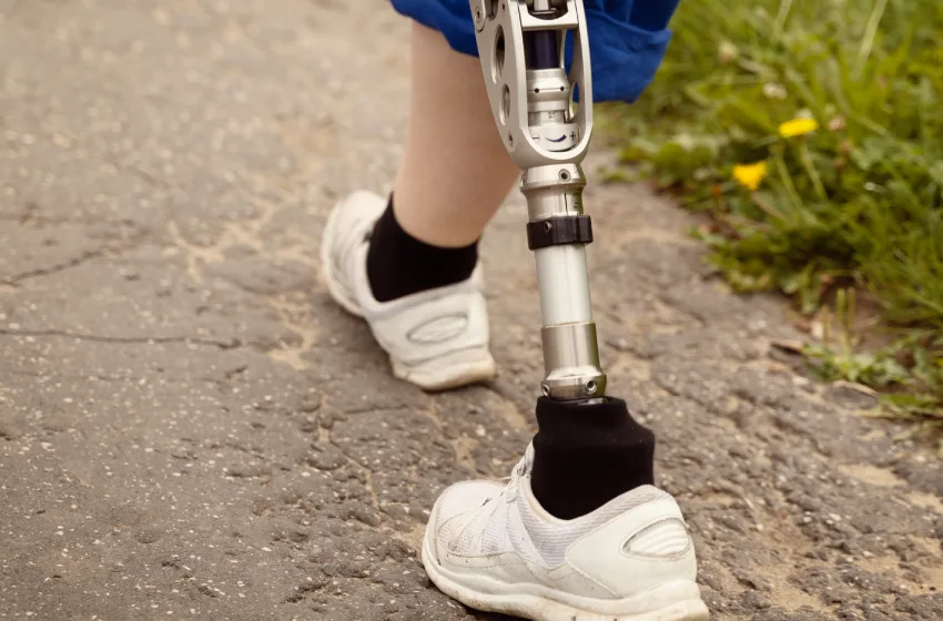 Empowering mobility: A dynamic banner showcasing advanced prosthetic leg solutions, guiding individuals on their journey to enhanced movement and freedom.