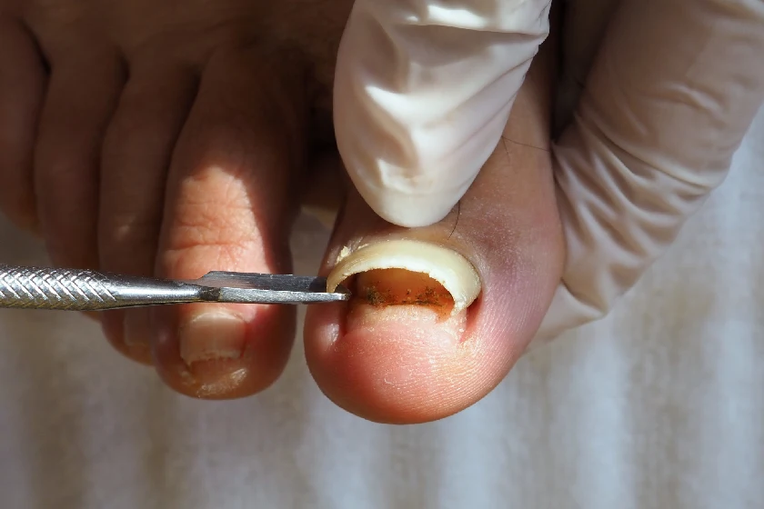 Footwear Solutions in Surat