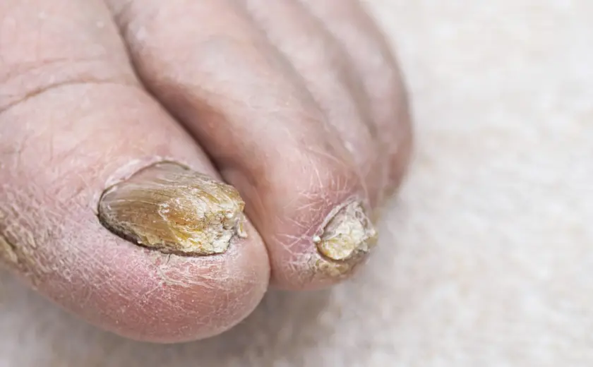 Empowering mobility: A dynamic banner showcasing advanced prosthetic leg solutions, guiding individuals on their journey to enhanced movement and freedom.