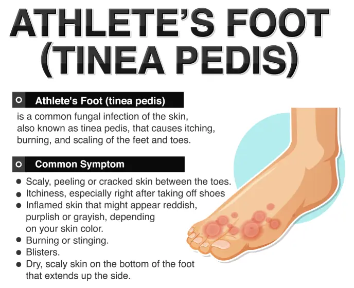 Footwear Solutions in Surat