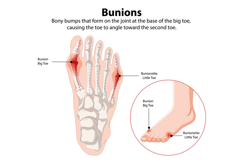 Footwear Solutions in Surat