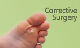 Corrective Surgery For Diabetic Foot