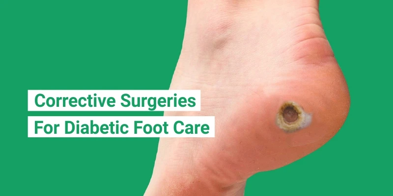 Corrective Surgeries for Diabetic Foot