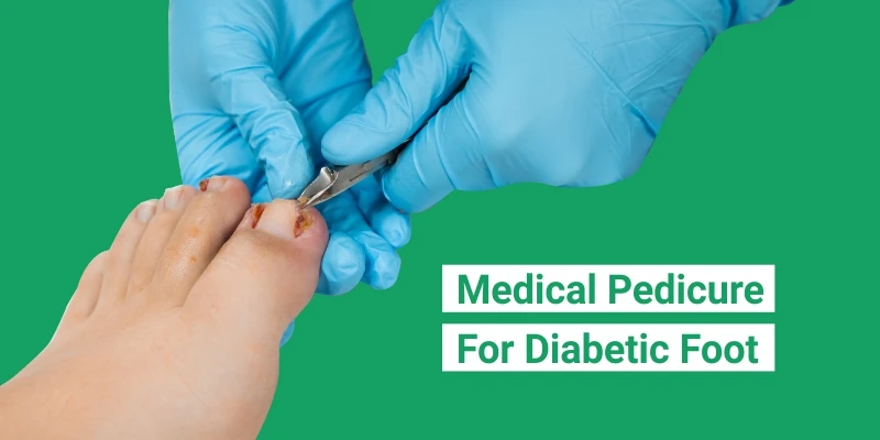Medical Pedicure for Diabetic Foot