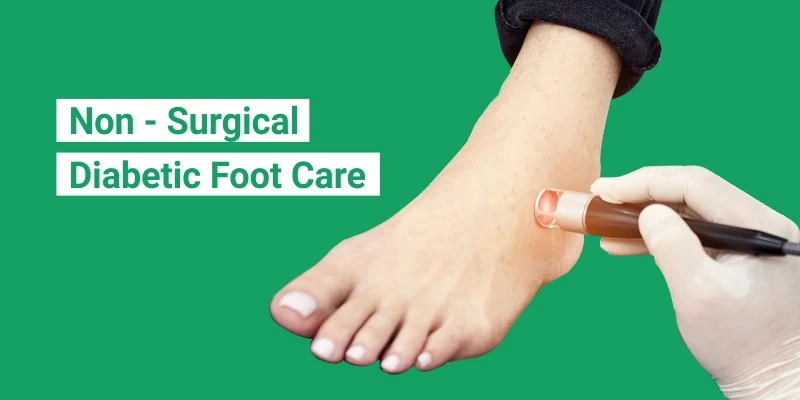 Non Surgical Diabetic Foot Care