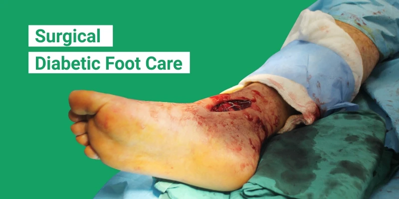 Surgical Diabetic Foot Care