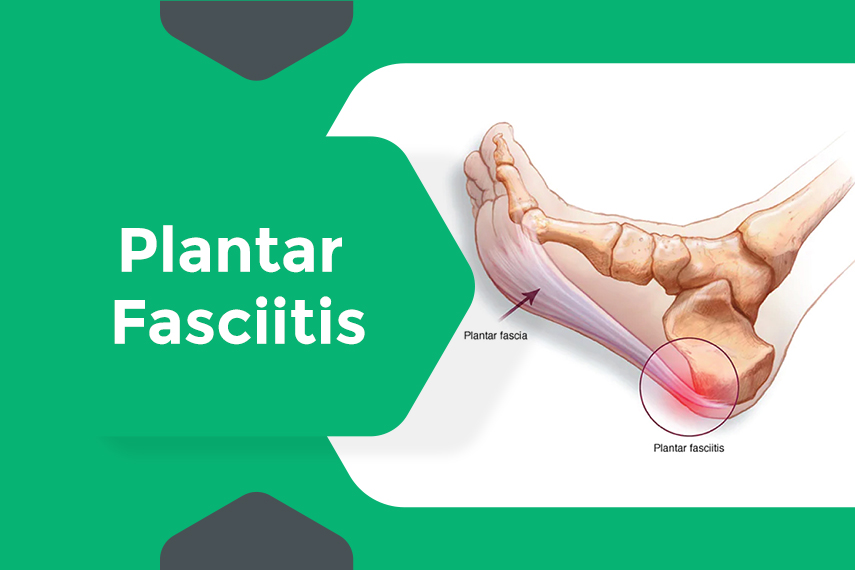 Plantar Heel Pain Differential Diagnosis | Diagnosis, Heel pain, Speech  therapy materials